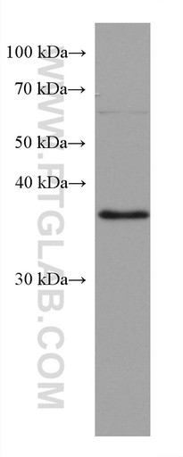 [67795-1-IG-150UL] RP2 Monoclonal antibody