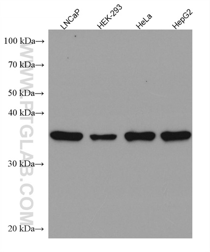 [67796-1-IG-20UL] TWF1 Monoclonal antibody