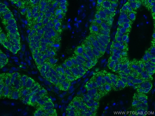 [67798-1-IG-150UL] CNOT4 Monoclonal antibody