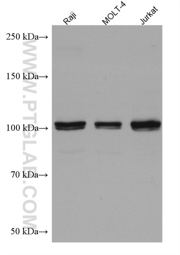 [67800-1-IG-150UL] FGFR4 Monoclonal antibody