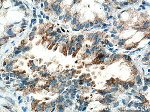 [67803-1-IG-20UL] HK3 Monoclonal antibody