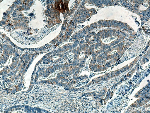 [67806-1-IG-150UL] PKMYT1 Monoclonal antibody