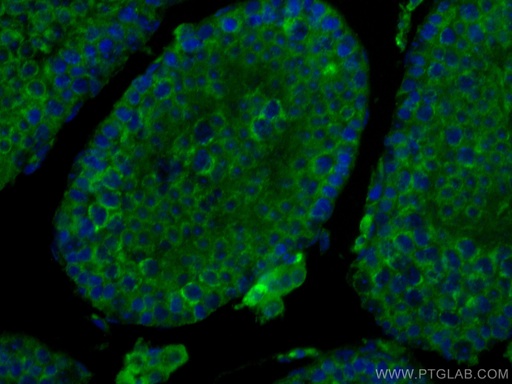 [67808-1-IG-150UL] SMCR7L Monoclonal antibody