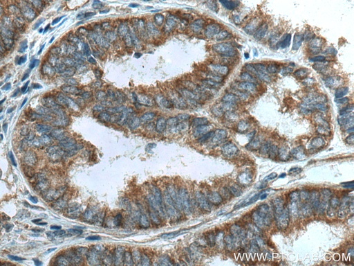 [67810-1-IG-20UL] LARP1 Monoclonal antibody