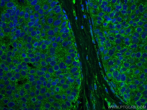 [67815-1-IG-20UL] DAPK1 Monoclonal antibody