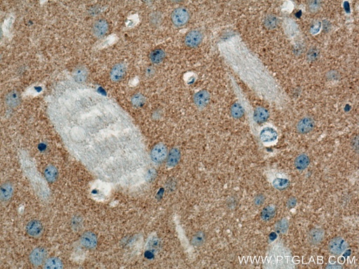 [67822-1-IG-20UL] VAMP2 Monoclonal antibody