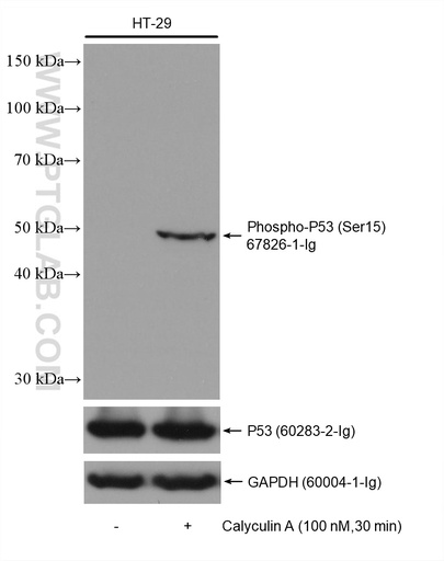[67826-1-IG-20UL] Phospho-P53 (Ser15) Monoclonal antibody