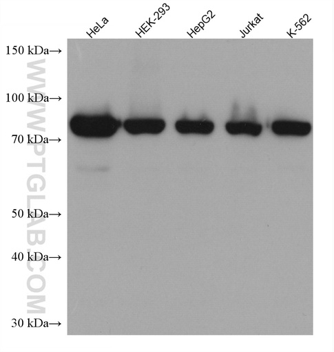 [67828-1-IG-150UL] TARS Monoclonal antibody