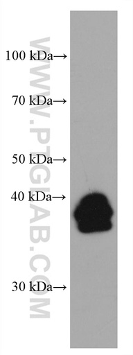[67834-1-IG-150UL] LMCD1 Monoclonal antibody