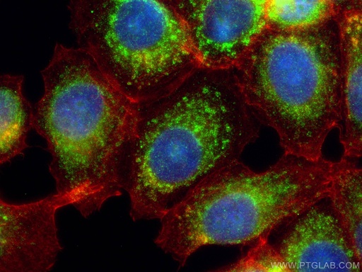 [67836-1-IG-20UL] OXCT1 Monoclonal antibody