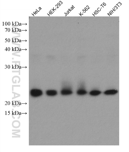 [67837-1-IG-150UL] RAB1B Monoclonal antibody