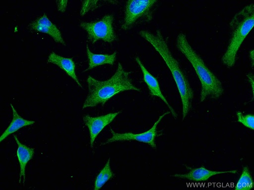 [67843-1-IG-150UL] CIP2A Monoclonal antibody
