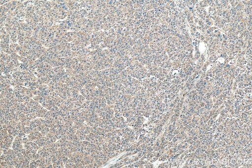 [67845-1-IG-20UL] VAPA Monoclonal antibody