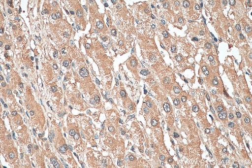 [67847-1-IG-150UL] PSMB1 Monoclonal antibody