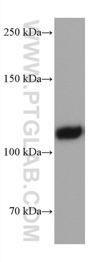 [67854-1-IG-20UL] EMCN Monoclonal antibody