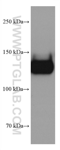 [67857-1-IG-20UL] GP1BA Monoclonal antibody