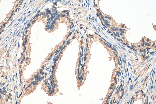 [67858-1-IG-150UL] GIT2 Monoclonal antibody
