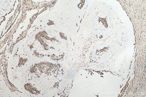 [67859-1-IG-20UL] ASH2L Monoclonal antibody