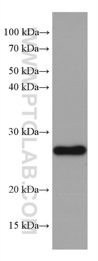 [67862-1-IG-150UL] GSTM1 Monoclonal antibody