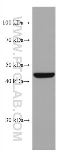 [67863-1-IG-20UL] HSP47 Monoclonal antibody