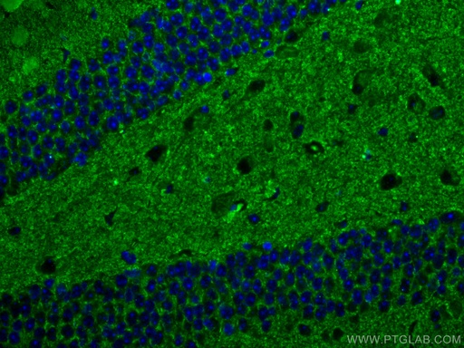 [67864-1-IG-150UL] Synaptophysin Monoclonal antibody