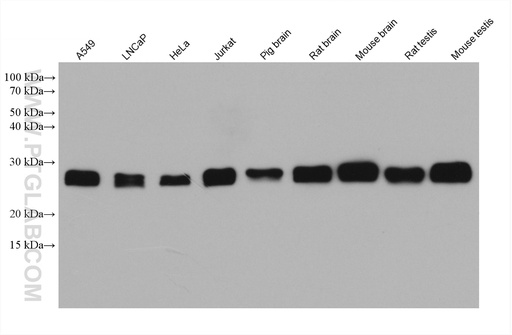 [67866-1-IG-150UL] CSNK2B Monoclonal antibody