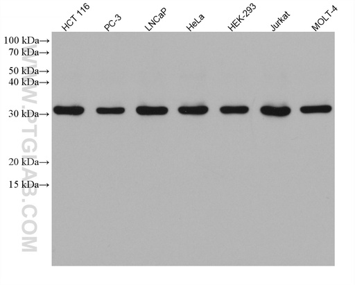 [67869-1-IG-20UL] AES Monoclonal antibody