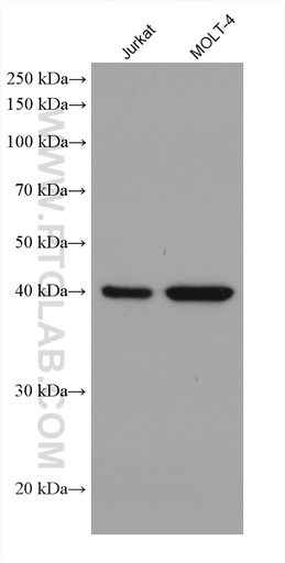 [67870-1-IG-150UL] ADA Monoclonal antibody