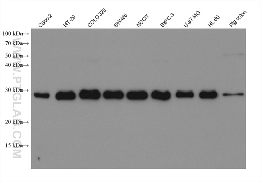 [67877-1-IG-20UL] PLEKHB2 Monoclonal antibody
