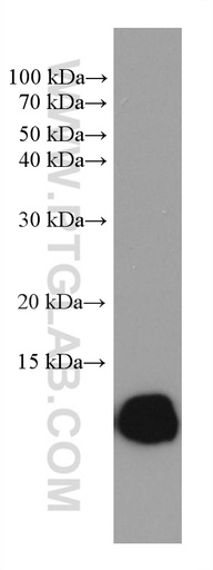 [67878-1-IG-150UL] HBZ Monoclonal antibody