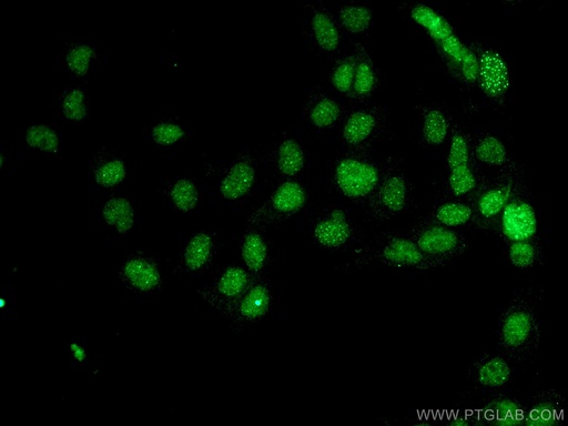 [67879-1-IG-20UL] DAXX Monoclonal antibody