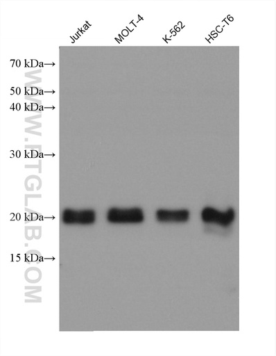 [67885-1-IG-150UL] CBFB Monoclonal antibody