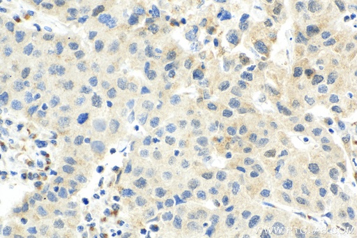 [67889-1-IG-20UL] CDK7 Monoclonal antibody
