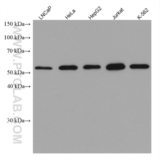 [67892-1-IG-150UL] KPNA3 Monoclonal antibody
