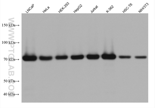 [67893-1-IG-20UL] GARS Monoclonal antibody