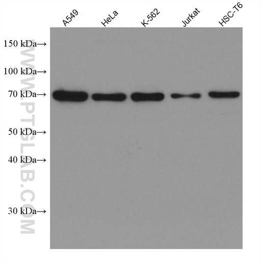 [67895-1-IG-20UL] KBTBD2 Monoclonal antibody