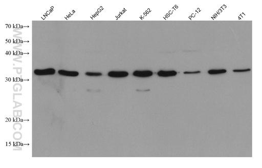 [67896-1-IG-150UL] SLC25A36 Monoclonal antibody