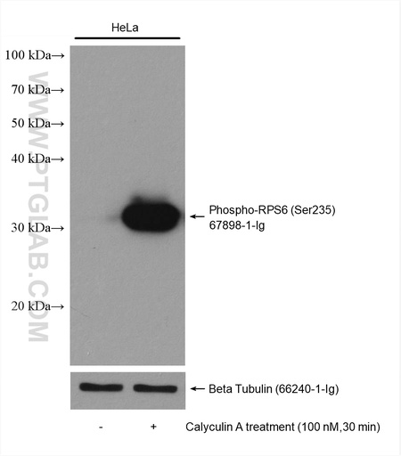 [67898-1-IG-20UL] Phospho-RPS6 (Ser235) Monoclonal antibody