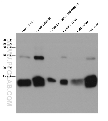 [67899-1-IG-150UL] HBB Monoclonal antibody