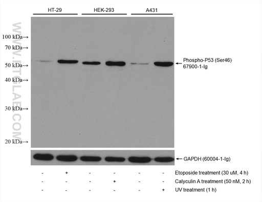 [67900-1-IG-20UL] Phospho-P53 (Ser46) Monoclonal antibody