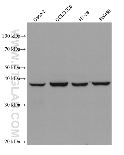 [67904-1-IG-150UL] WIF1 Monoclonal antibody
