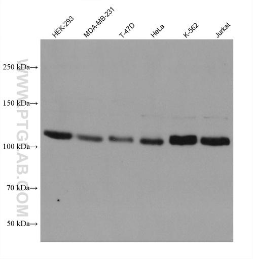[67906-1-IG-150UL] ROR2 Monoclonal antibody