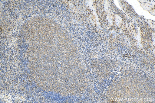 [69018-1-IG-25UG] NeutraKine® IL-10 Monoclonal antibody