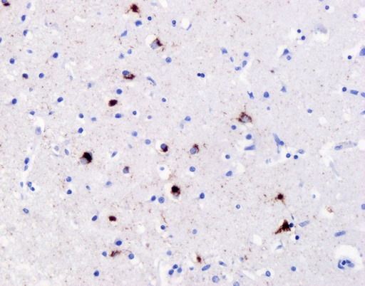 [80007-1-RR-100UL] Phospho-TDP43 (Ser409/410) Recombinant antibody