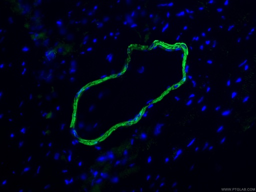[80008-1-RR-100UL] smooth muscle actin specific Recombinant antibody