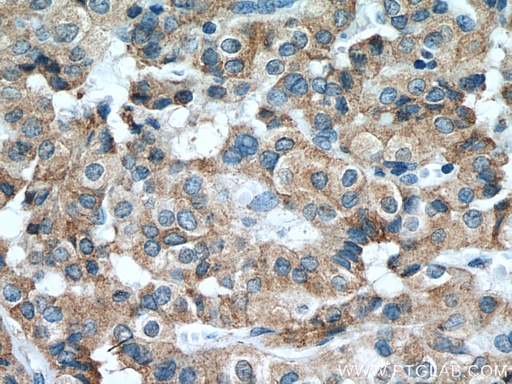 [80017-1-RR-100UL] calreticulin Recombinant antibody