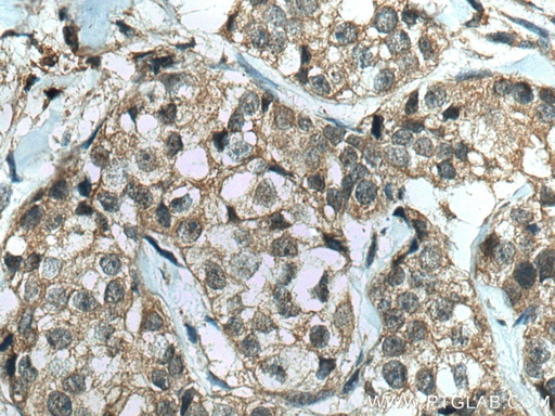 [80019-1-RR-20UL] IkB Alpha Recombinant antibody