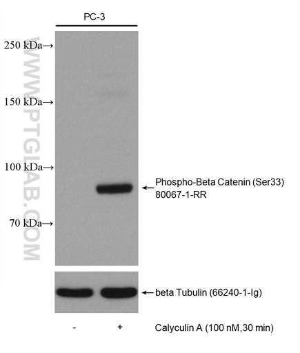 [80067-1-RR-20UL] Phospho-Beta Catenin (Ser33) Recombinant antibody