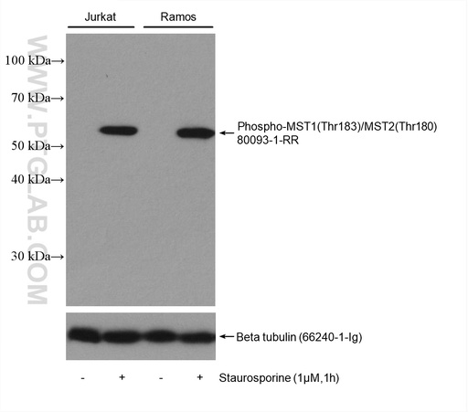 [80093-1-RR-20UL] Phospho-MST1 (Thr183)/MST2 (Thr180) Recombinant antibody