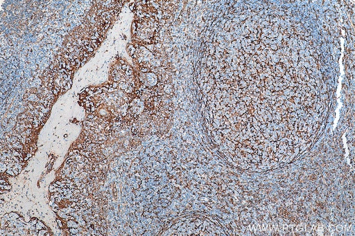 [80165-1-RR-100UL] TMEM173/STING Recombinant antibody